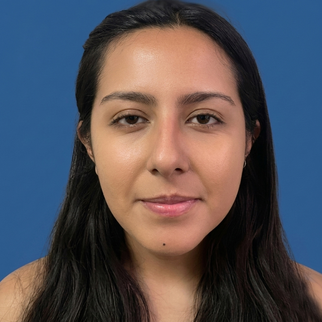 Cirugía de tabique desviado y estética nasal en Quito - Paciente real , Cirugía de nariz femenina