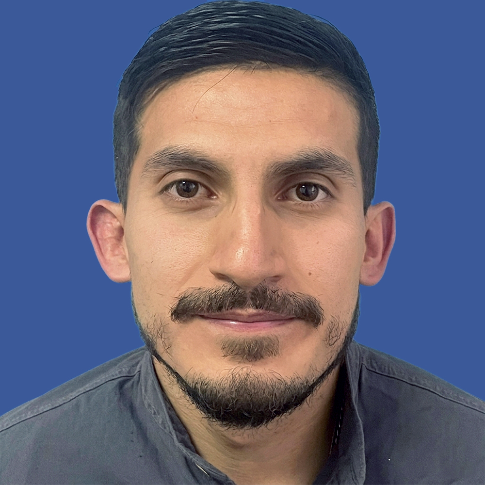Cirugía masculina de tabique desviado y estética nasal en Quito - Paciente real, rinoplastia
